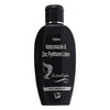 Ketonol Zpto Lotion 100Ml