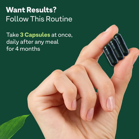 Oziva Advanced Hair Growth Actives Reduces Thinning Hair & Improves Scalp Coverage | 90 Capsules
