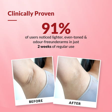 Fixderma Nigrifix Underarm Velvet Musk Roll On Brightenss Underarm For Sensitive Skin 60 Ml