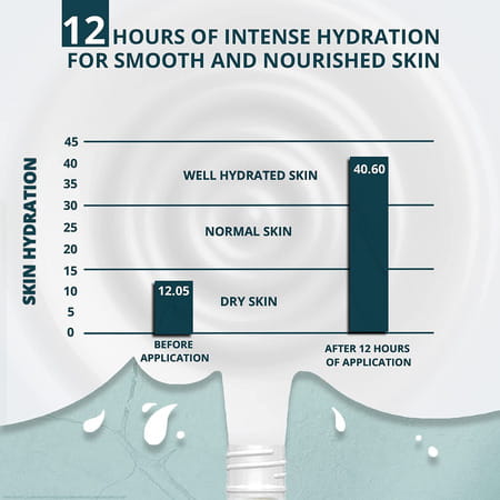 Venusia Max Moisturizing | Lotion | 300 Gm | Pack Of 6