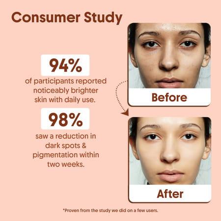 Aravi Organic Vitamin C Face Serum For Bright | Glowing & Even-Toned Skin - 30ml