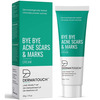 Dermatouch Bye Bye Acne Scars & Marks Cream || Acne Scars Corrector || Gives Even Skin Tone - 30g