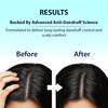 Dermistry Anti Dandruff Treatment Piroctone Climbazole & Zpto Hair Mask Flakes Dry Itchy Scalp 200Ml