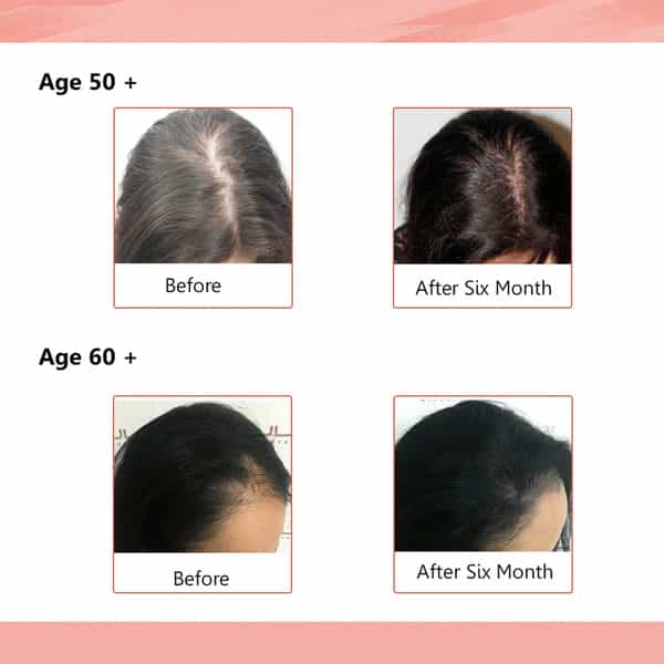 Sheneed Hair Supplement With 11+Nutrients-60 Capsules
