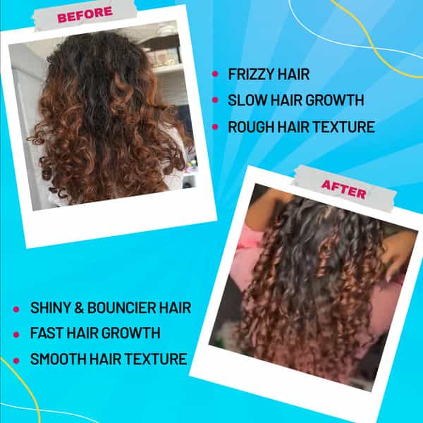 Chicnutrix Bounce - Hrc | Biotin | Selenium - Good Hair Day | Everyday - Raspberry