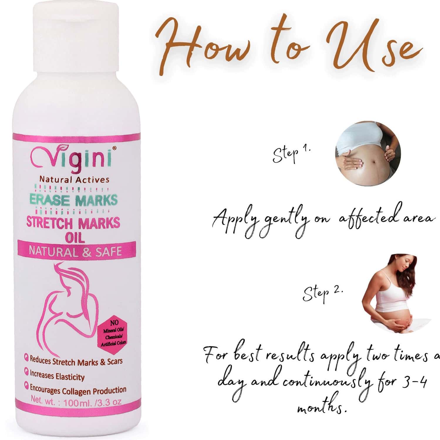 Buy VIGINI NATURAL ERASE STRETCH MARKS SCARS ANTI PIGMENTATION REMOVAL