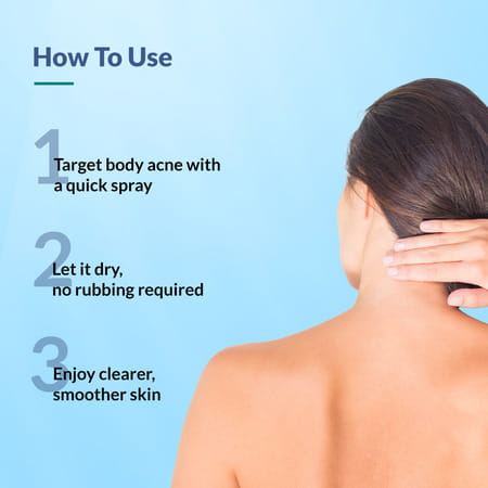 Fixderma Salyzap For Body Acne 2% Salicylic Acid Body Spray 100 Ml