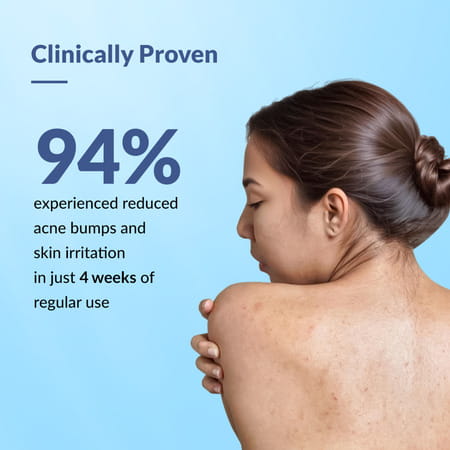 Fixderma Salyzap For Body Acne 2% Salicylic Acid Body Spray 100 Ml