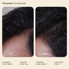 Arata Hair Growth Intensive Serum | Reduces Hair Fall & Thinning | 30 Ml