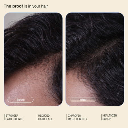 Arata Hair Growth Intensive Serum | Reduces Hair Fall & Thinning | 30 Ml