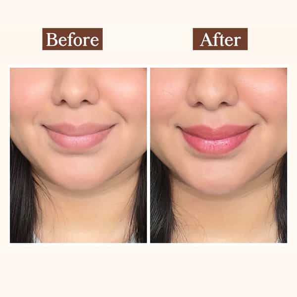 Tnw The Natural Wash Peptide Lip Balm Vanilla | Hydrating & Softening Care 5 Gm
