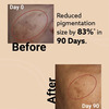 Melora Skin Melasma Tablets | Oral Supplement For Pigmentation & Dark Spots - 30N