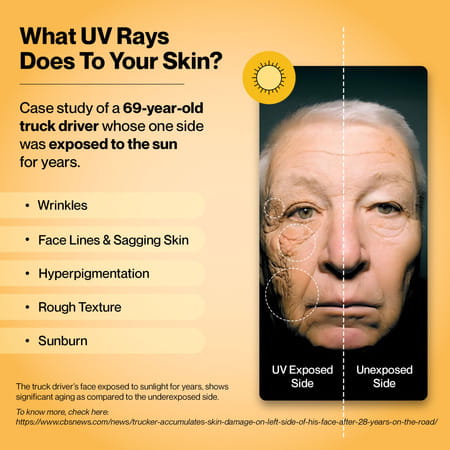 Setu Skin Protect - First Drinkable Sunshield | Reduces Pigmentation ( 30 Sachets - Strawberry)