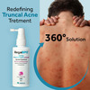 Regabpo Acne Control For Truncal & Body Acne Spray 60 Ml