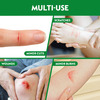 Dettol Antiseptic Skin Cream - For Wounds- 30Gm