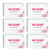 No Scar Soap 150G Pack Of 6