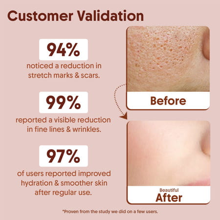 Aravi Organic Vitamin E Face Oil For Glowing | Hydrated & Nourished Skin - 30ml