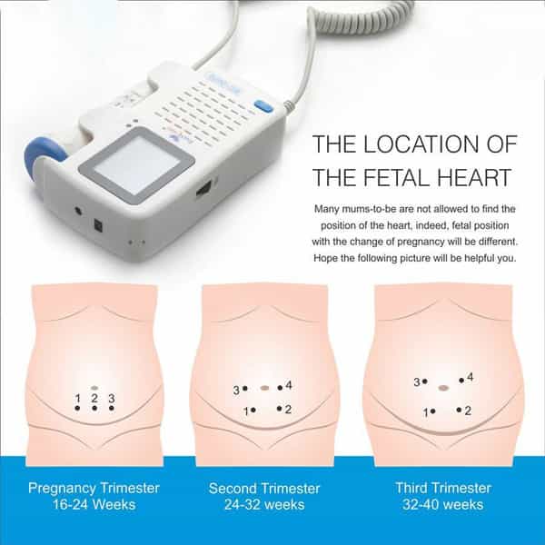 Easycare (German Tech.) Fetal Doppler - Ec2070