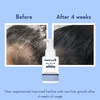 Wishcare Hair Growth Serum Concentrate - Redensyl|Anagain|Caffeine|Biotin|Keratin|Rice Water - 20Ml