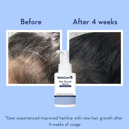 Wishcare Hair Growth Serum Concentrate - Redensyl|Anagain|Caffeine|Biotin|Keratin|Rice Water - 20Ml