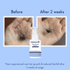 Wishcare Hair Growth Serum Concentrate - Redensyl|Anagain|Caffeine|Biotin|Keratin|Rice Water - 20Ml