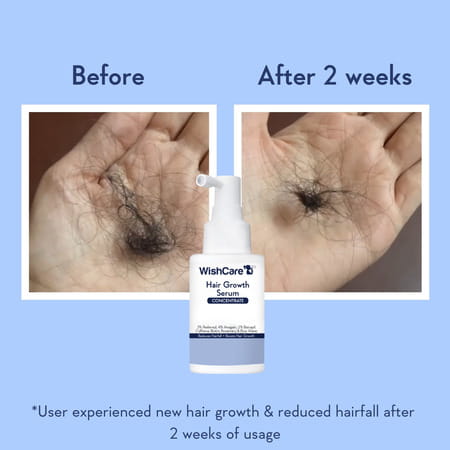 Wishcare Hair Growth Serum Concentrate - Redensyl|Anagain|Caffeine|Biotin|Keratin|Rice Water - 20Ml
