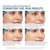Yuderma Melarid -Trx Serum | Ph 3.5 | Melano Correction 40 Ml