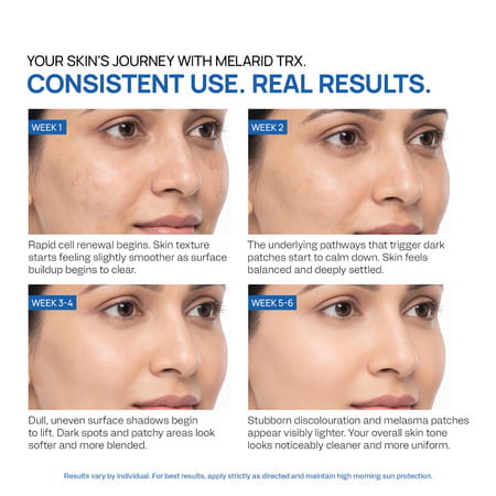 Yuderma Melarid -Trx Serum | Ph 3.5 | Melano Correction 40 Ml