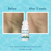 Wishcare Under Arm Roll On Serum - 5% Aha, 3% Kojic Acid - Underarm Lightening & Odour Control -Aqua