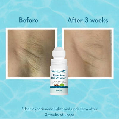 View product image 3