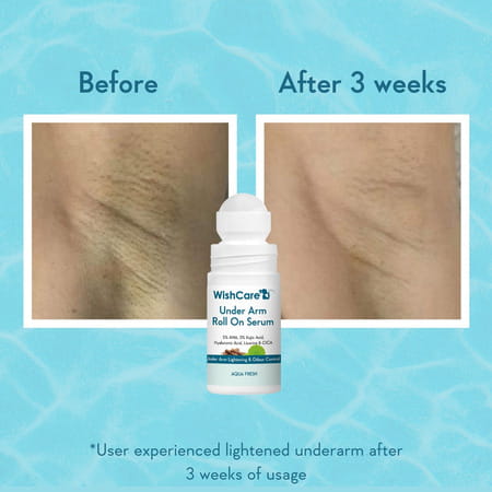 Wishcare Under Arm Roll On Serum - 5% Aha, 3% Kojic Acid - Underarm Lightening & Odour Control -Aqua