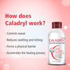 Caladryl Skin Allergy Lotion For Rashes | Sunburn | Prickly Heat And Insect Bites- 65ml