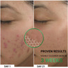 Sereko Clear Corrective Serum With 2% Salicylic Acid Bha For Active Acne Reducing Sebum 30 Ml
