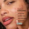 Sereko Clear Corrective Serum With 2% Salicylic Acid Bha For Active Acne Reducing Sebum 30 Ml