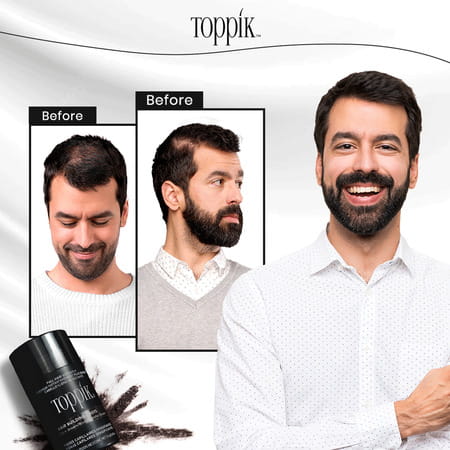 Toppik Hair Building Fibers Black 12 - 55 Gm Univ