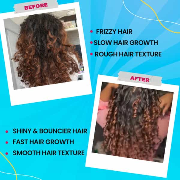 Chicnutrix Bounce - Hrc | Biotin | Selenium - Good Hair Day | Everyday - Raspberry (Pack Of 60)