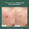 Conscious Chemist Rapid Relief Acne Spot Gel | 2% Salicylic & Azelaic Acid | 15G