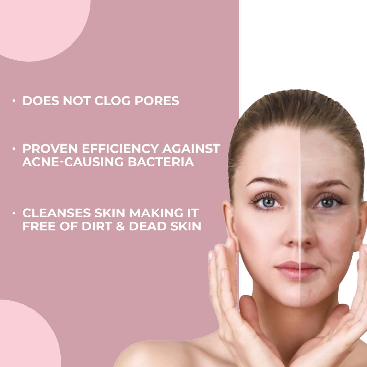 Buy I2 ANTI ACNE FACE CLEANSER SPRAY FOR PIMPLES, PARABEN FREE, ACNE