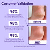 Aravi Organic 20% Urea Foot Roll-On For Cracked Heels & Pigmentation - 50Ml