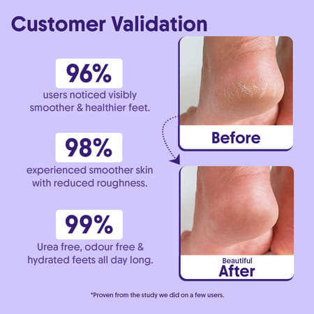 Aravi Organic 20% Urea Foot Roll-On For Cracked Heels & Pigmentation - 50ml