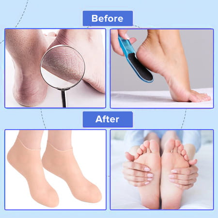 Dr Foot Silicone Socks | Anti Slip Silicone Moisturizing Socks | Dry Cracking Skin | Size L - 1 Pair