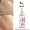 Novology Pigmentation Serum Bi-Phasic Face Serum For Hyperpigmentation & Dark Spots (28Ml)