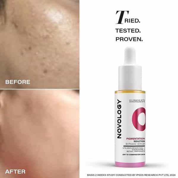 Novology Pigmentation Serum Bi-Phasic Face Serum For Hyperpigmentation & Dark Spots (28Ml)