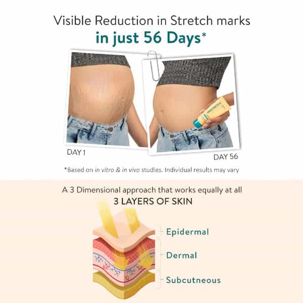 Inostretch Stretch Mark & Scar Cream With Rutin & Peptides| Paraben-Free Formula 60G