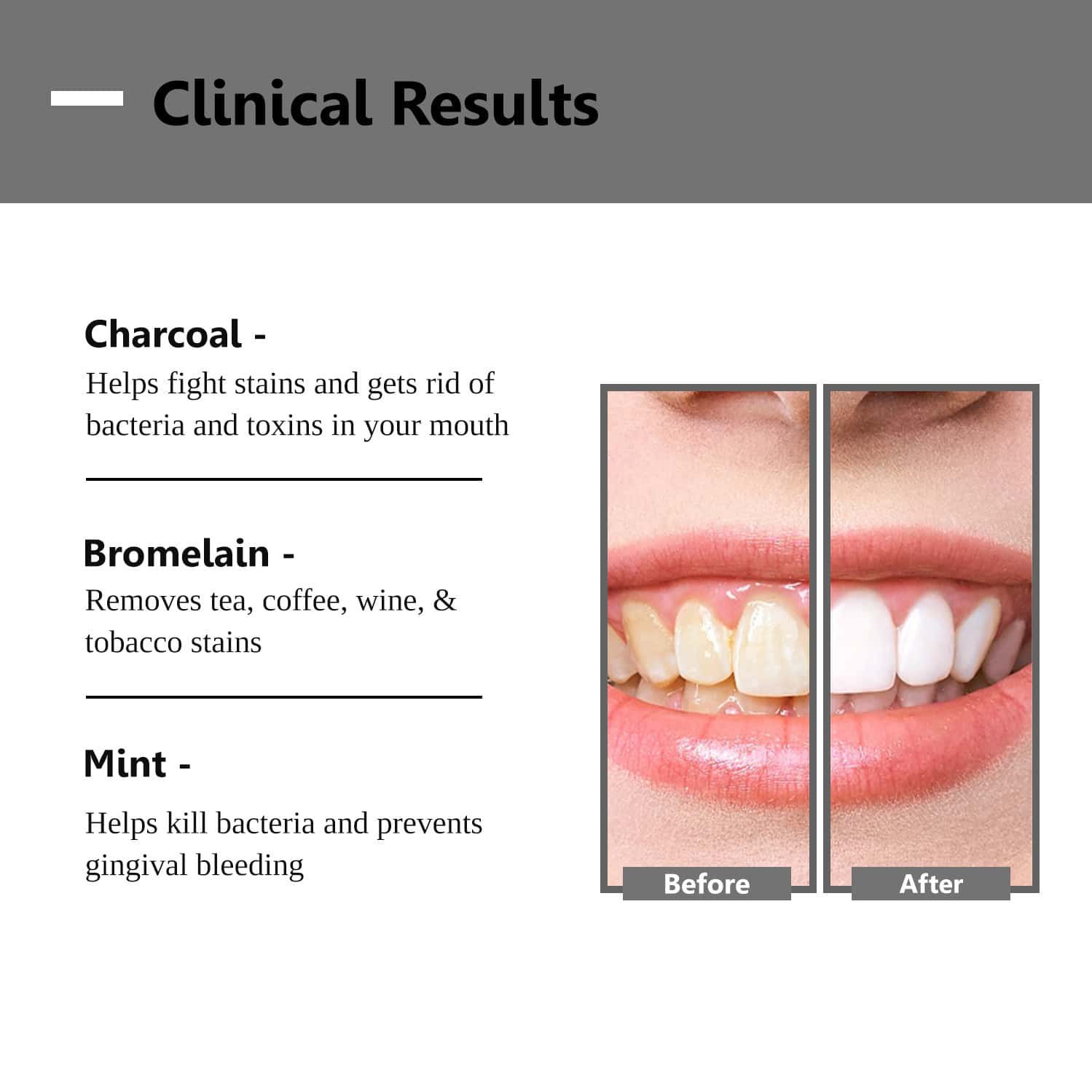 Buy ORALVIT ACTIVATED CHARCOAL TEETH WHITENING POWDER NATURAL, VEGAN