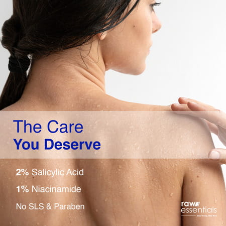 Raw Essentials Bacne Control Body Wash | 2% Salicylic Acid | Niacinamide | Sls & Paraben Free 300ml