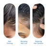 Be Bodywise Hair Growth Serum Roll On | Reduces Hairfall & Thinning | No Added Sugar | 25 Ml