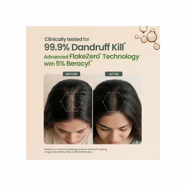 Nat Habit Anti-Dandruff Shampoo | 99.9 % Dandruff Kill With Advances Zero Flake Technology | 250 Ml