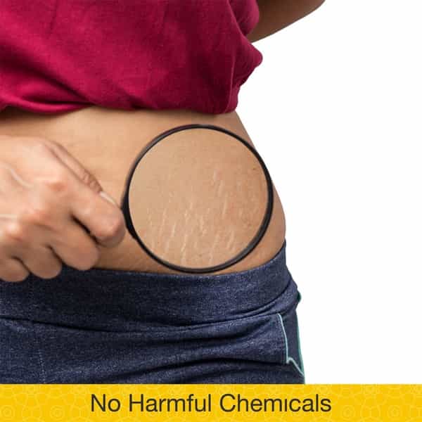 Omved Therapies Anti Stretch Belly Balm -40 G