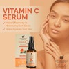 Upakarma Vitamin C Serum For Face To Restore And Renews Skin -30Ml
